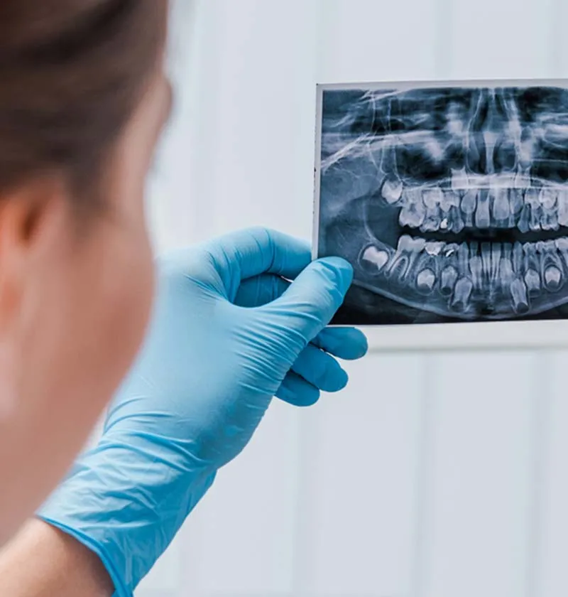 Dental assistant holding X-ray scan