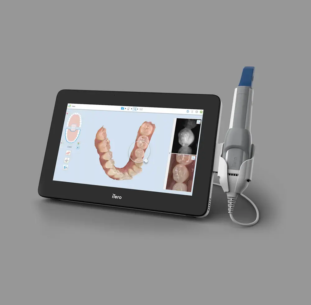 iTero device