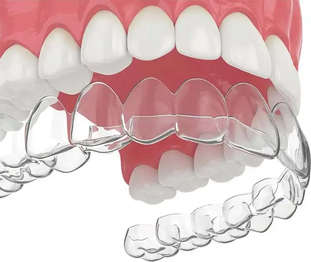 Clear retainer