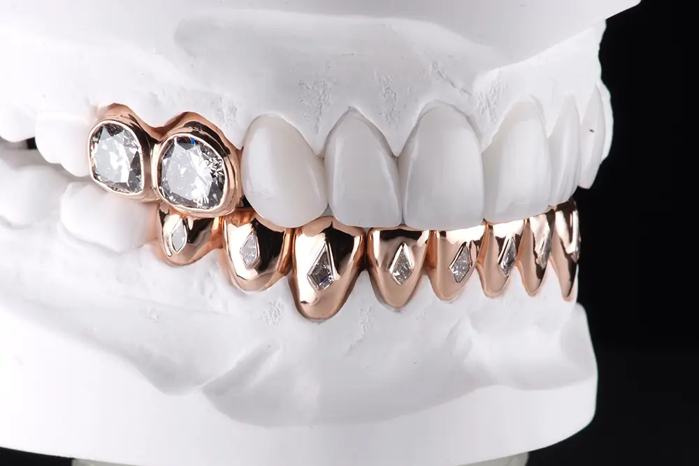 Diamonds in teeth